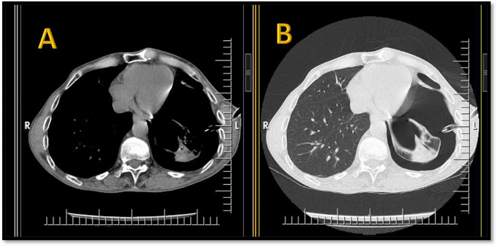 Fig. 6