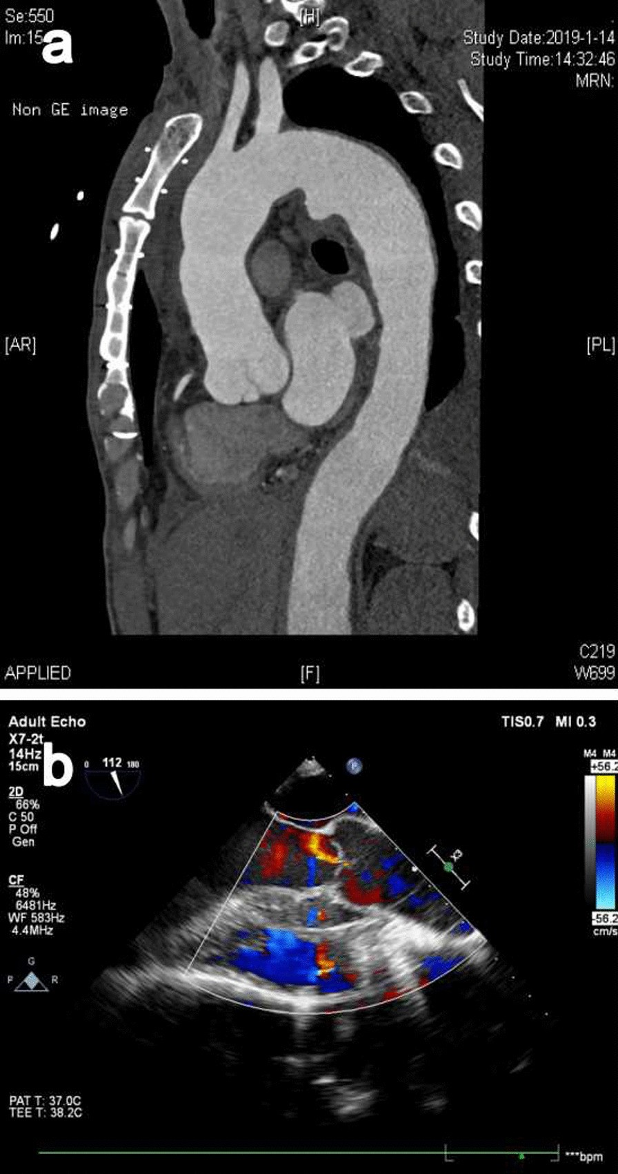 Fig. 3