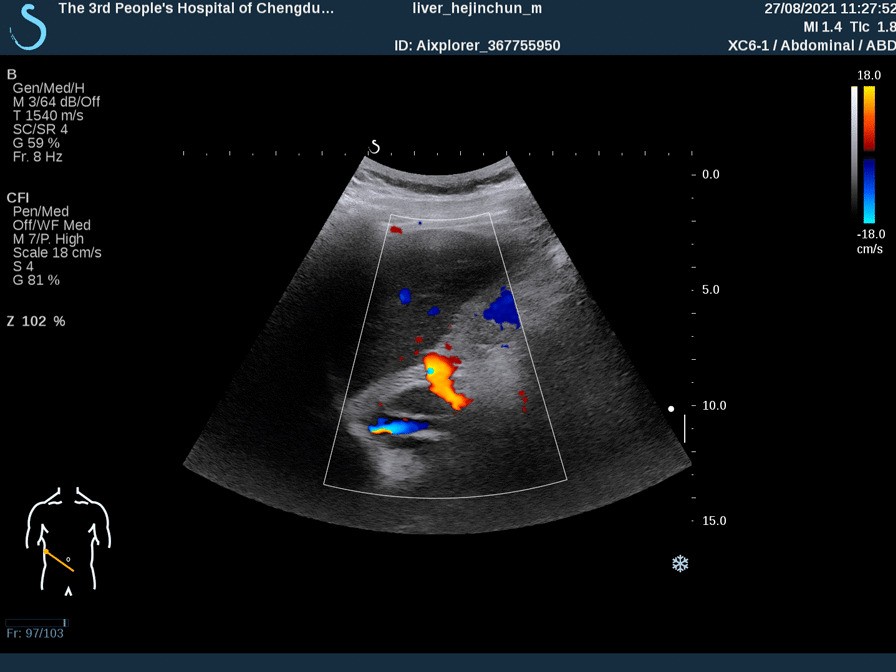 Fig. 4