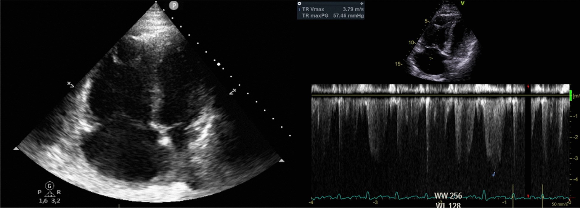 Fig. 3