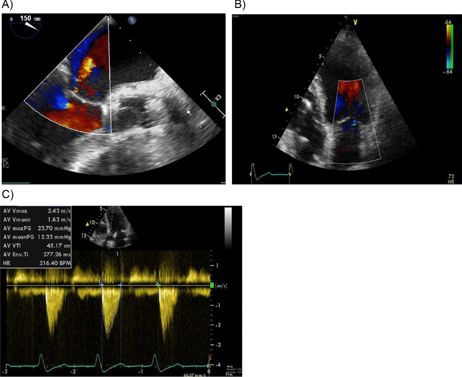 Fig. 2