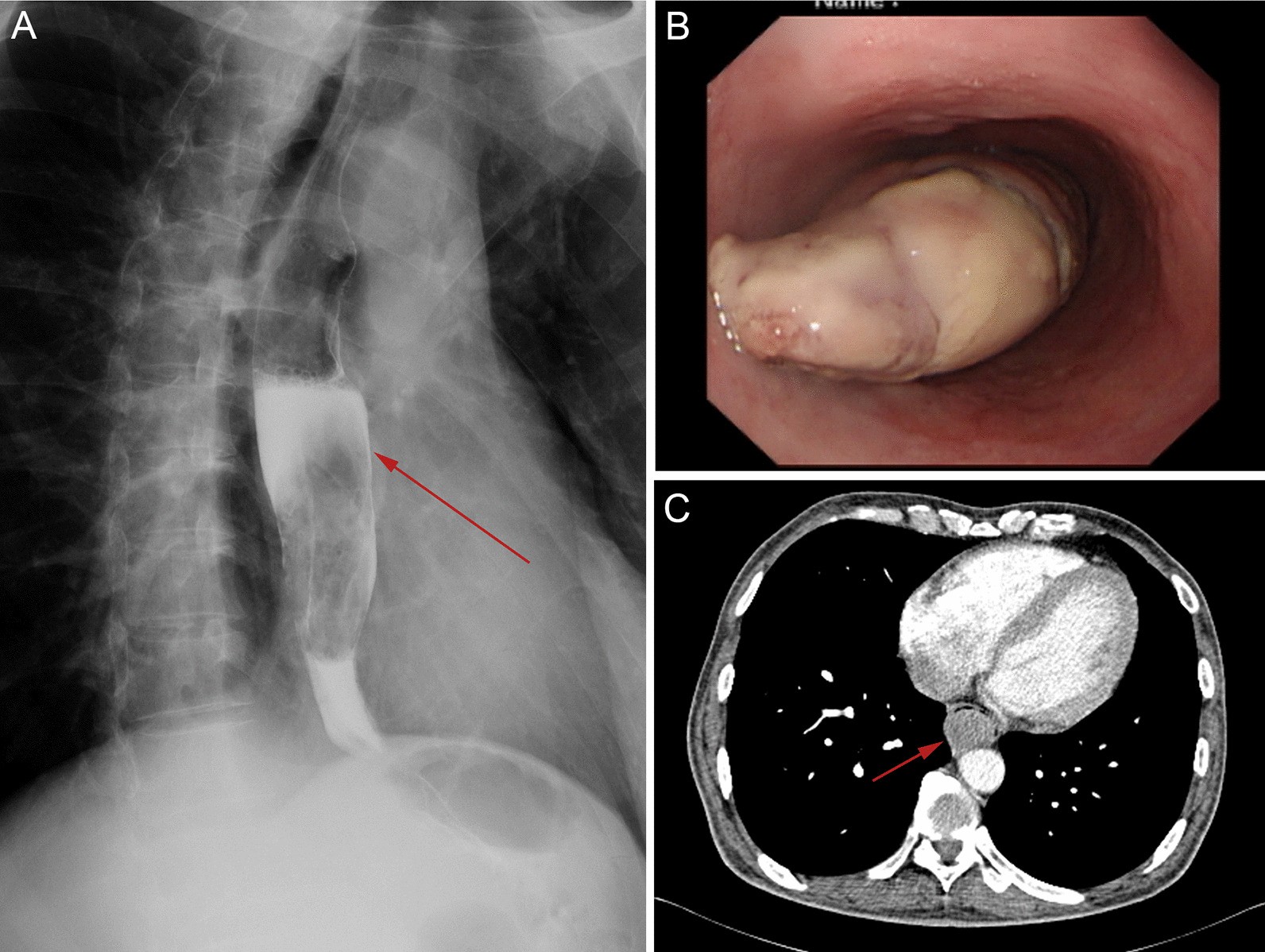 Fig. 1