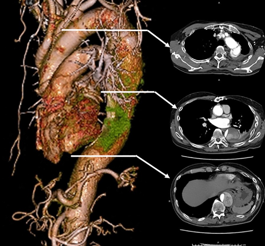 Fig. 1