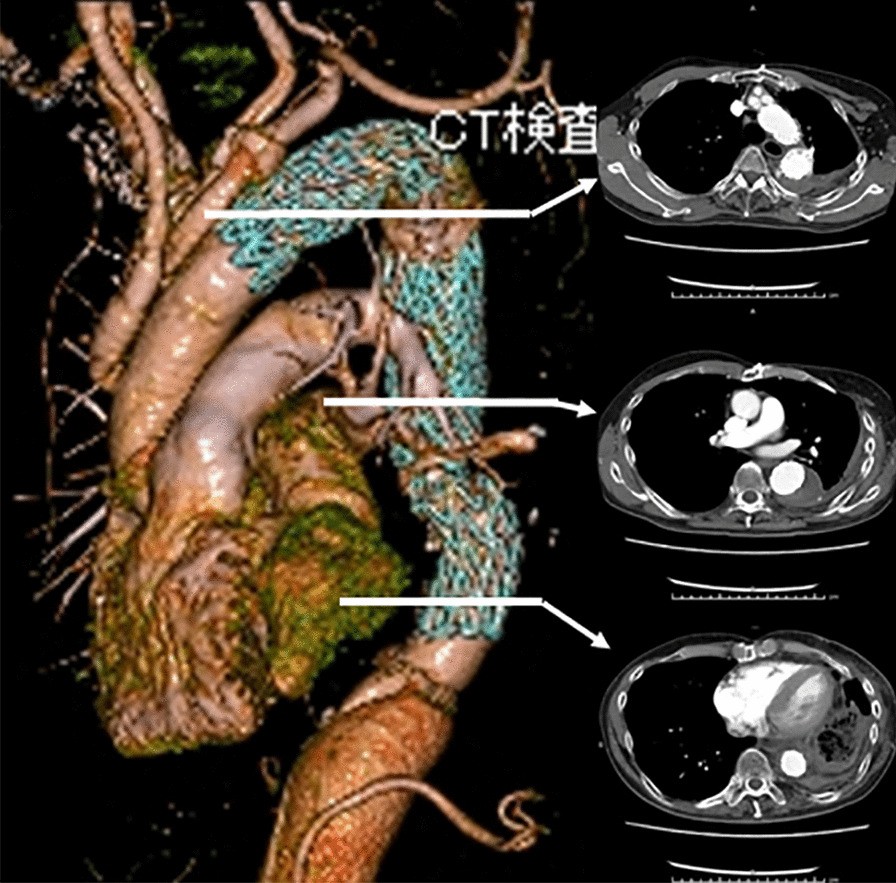 Fig. 3