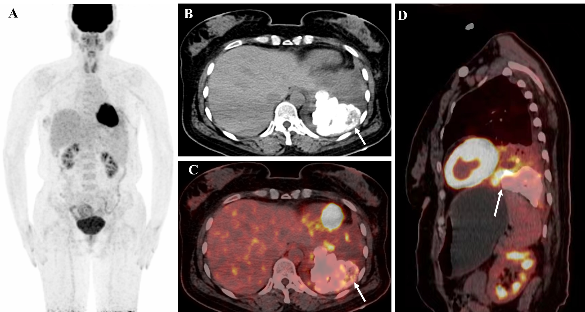 Fig. 1