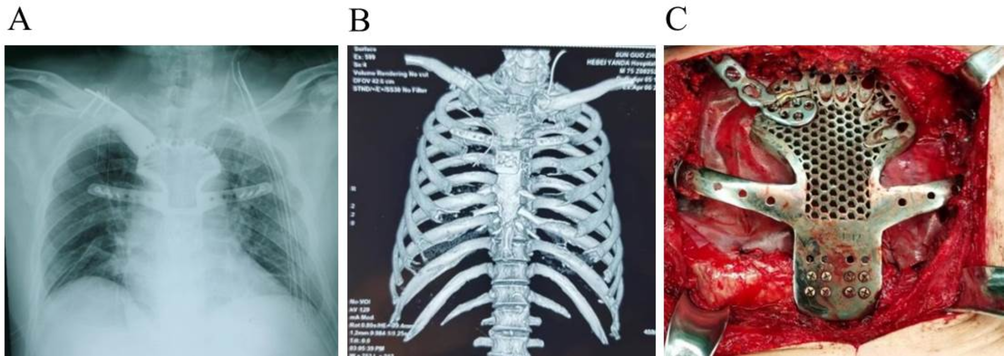 Fig. 4