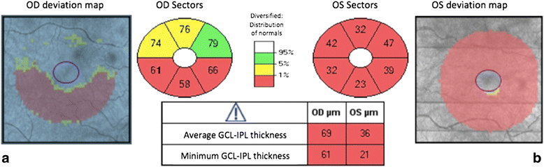 Fig. 4