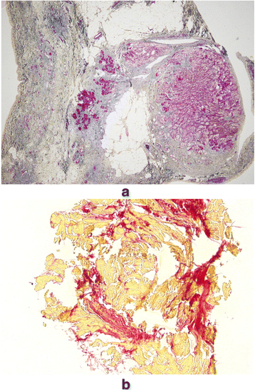 Fig. 10