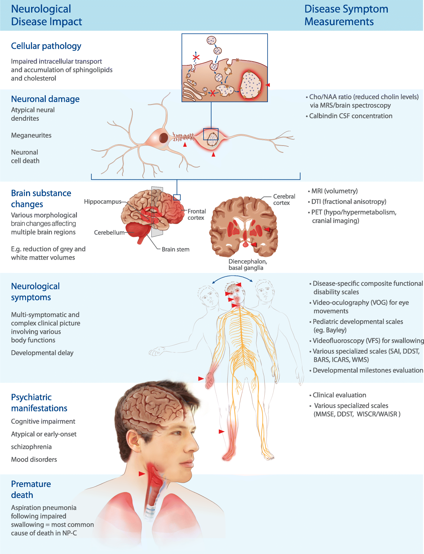 Miglustat in Niemann-Pick disease type C patients: a review, Orphanet  Journal of Rare Diseases