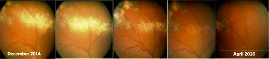 Fig. 1 (abstract P16).