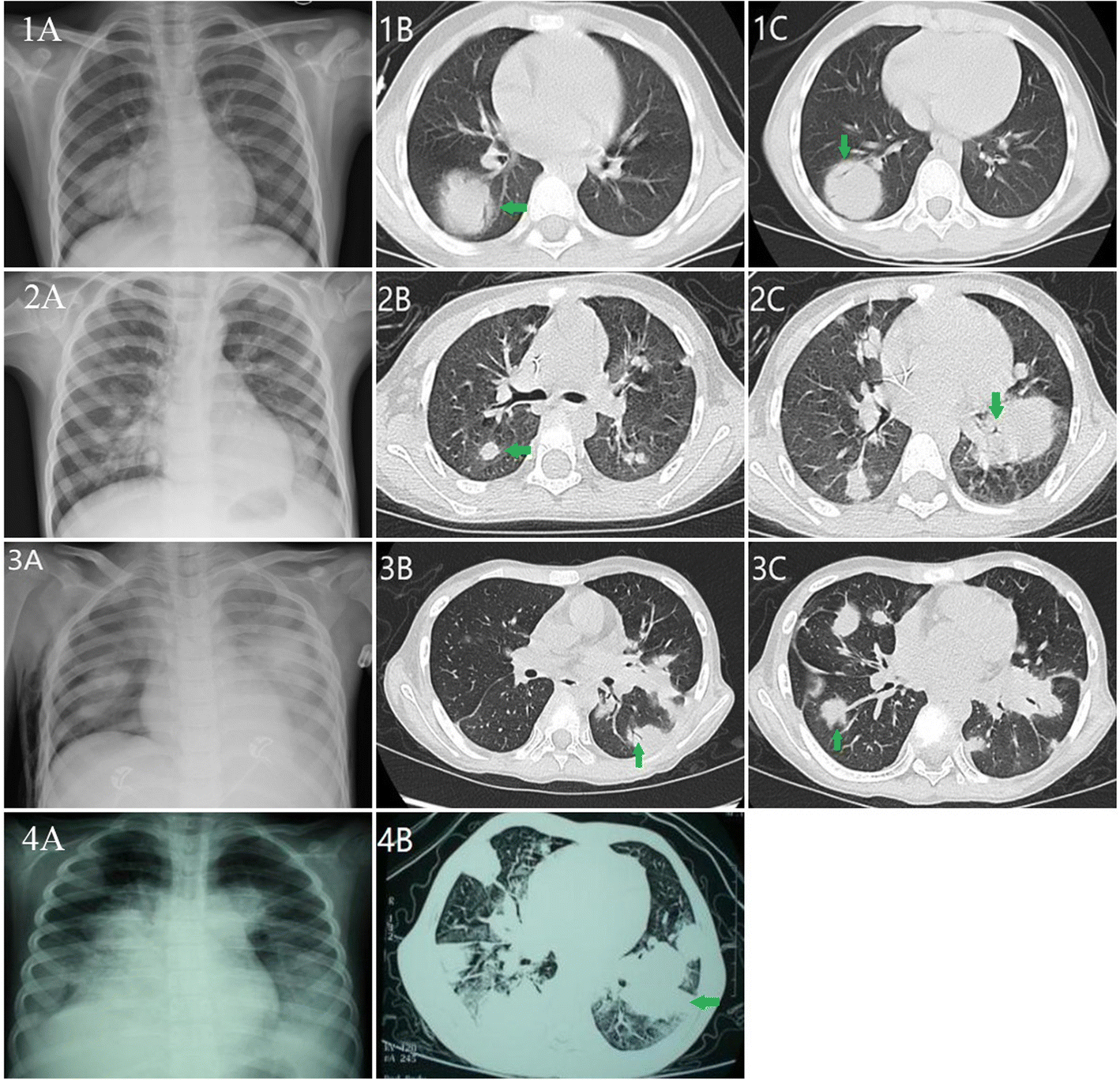 Fig. 1