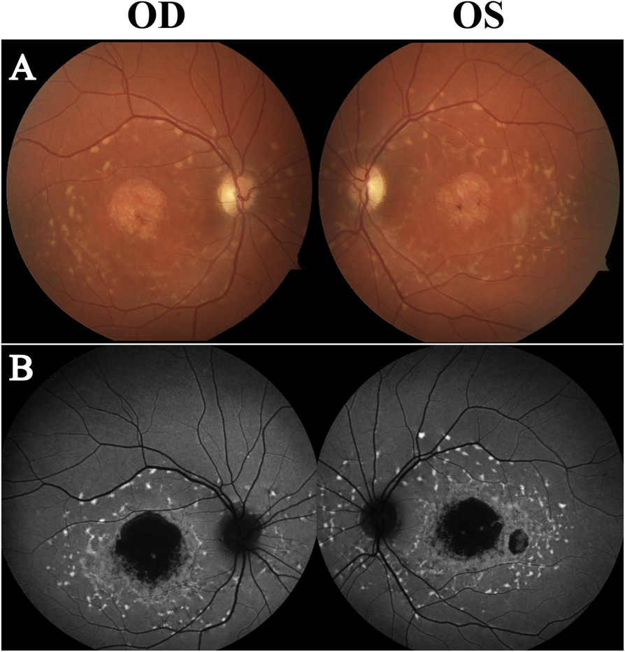 Fig. 2