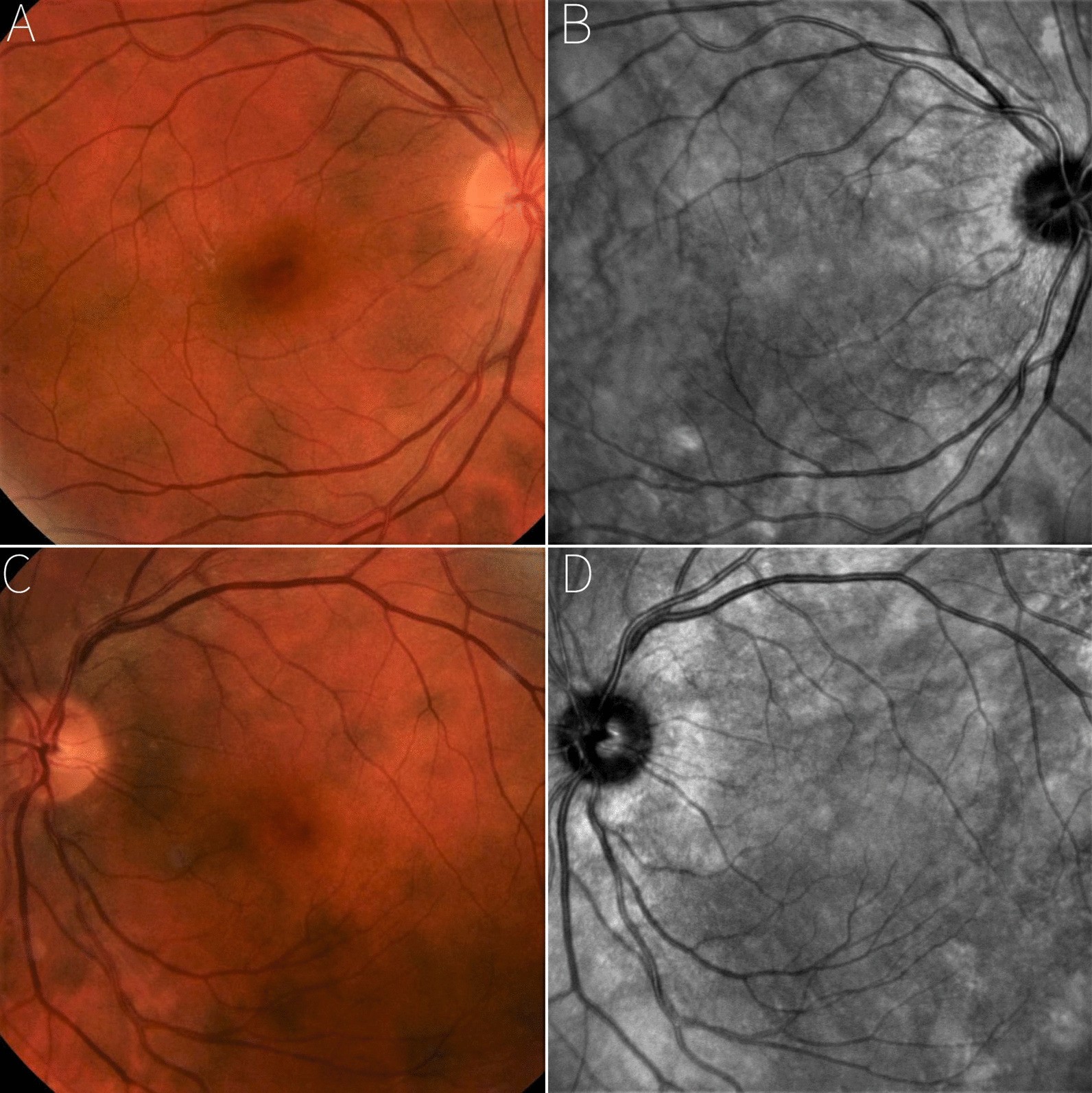 Fig. 2