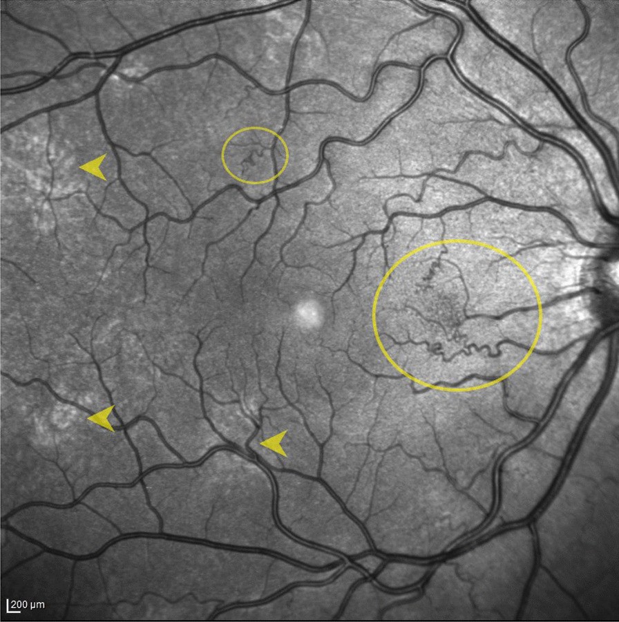 Fig. 3