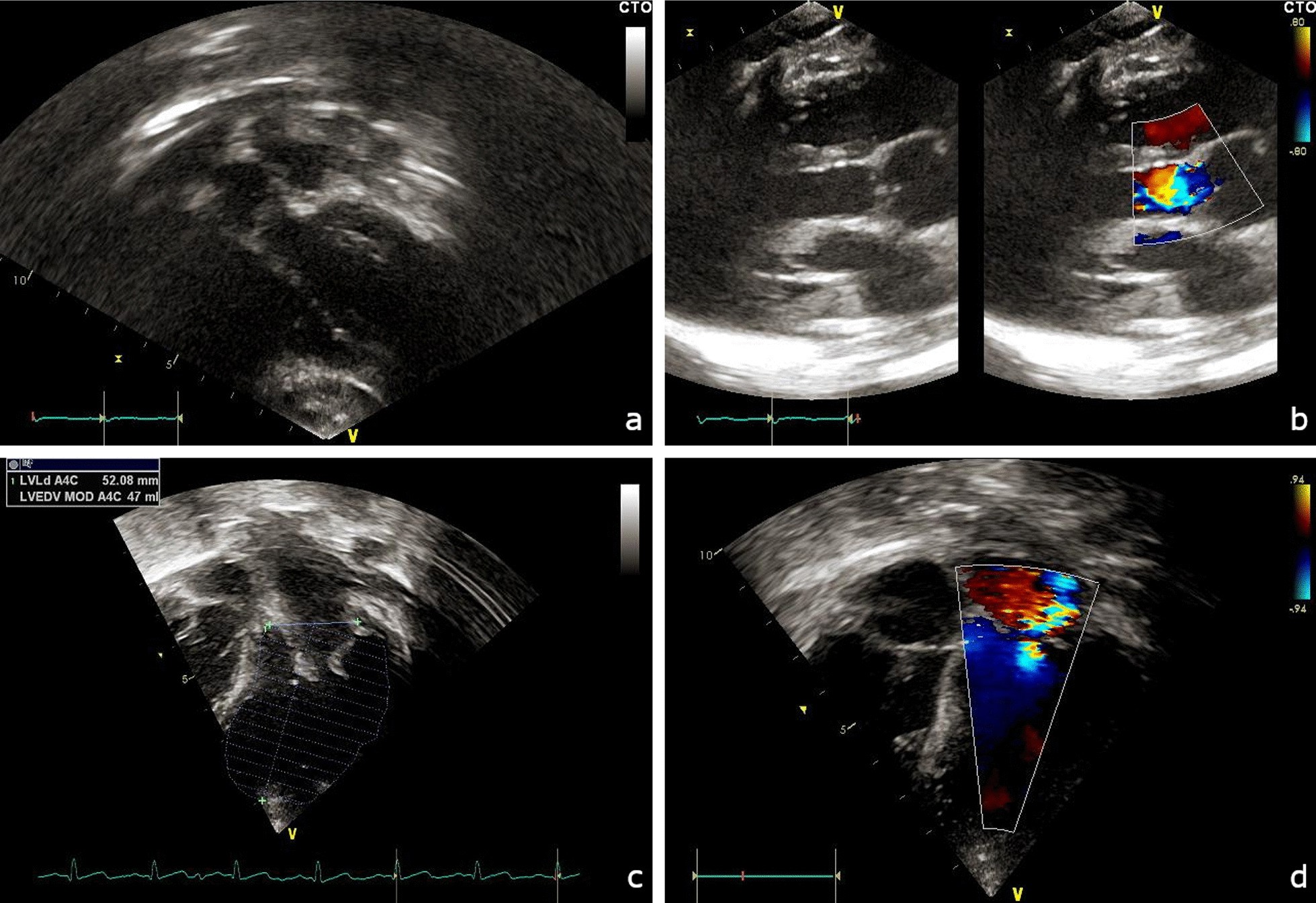 Fig. 2