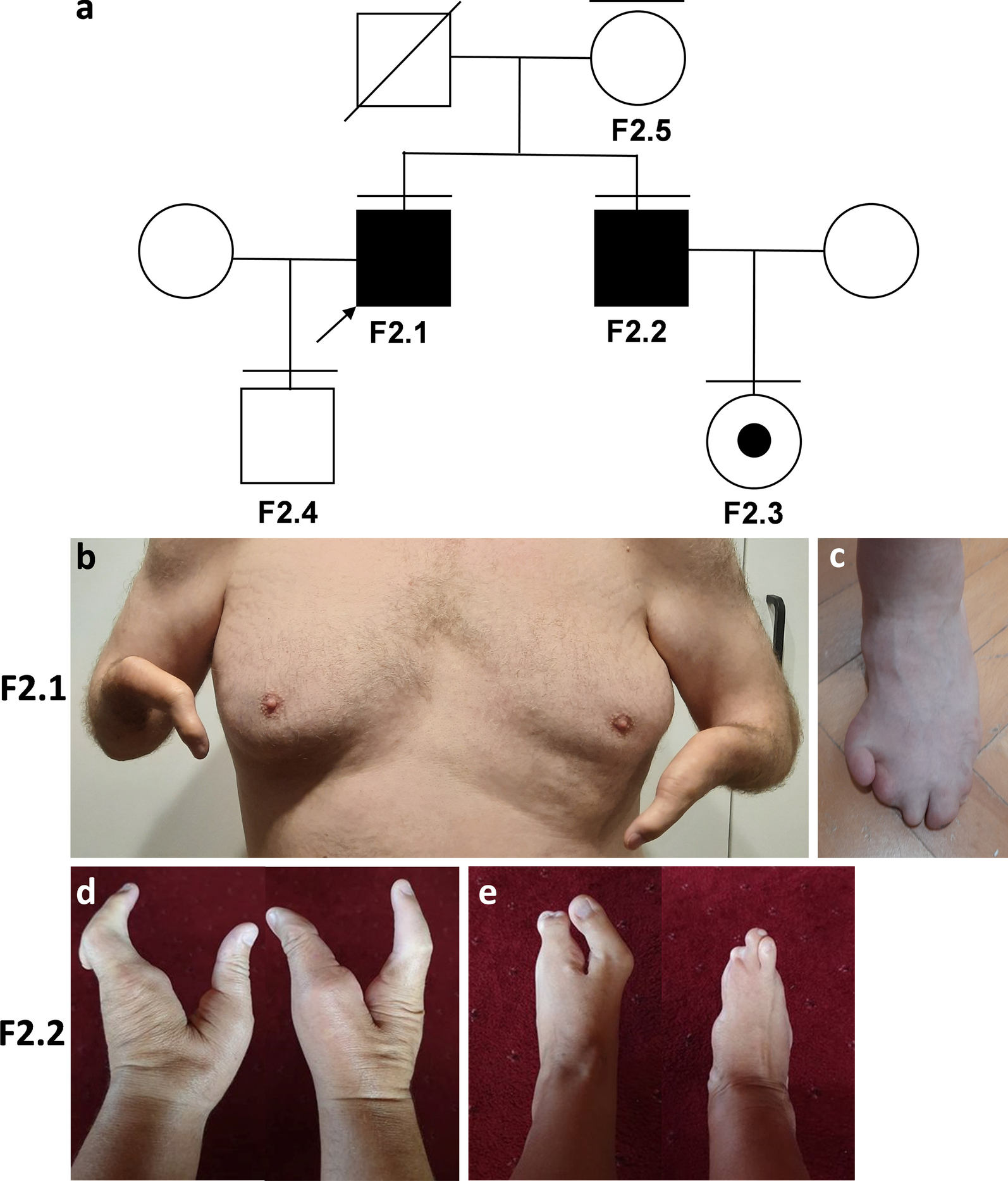 Fig. 2