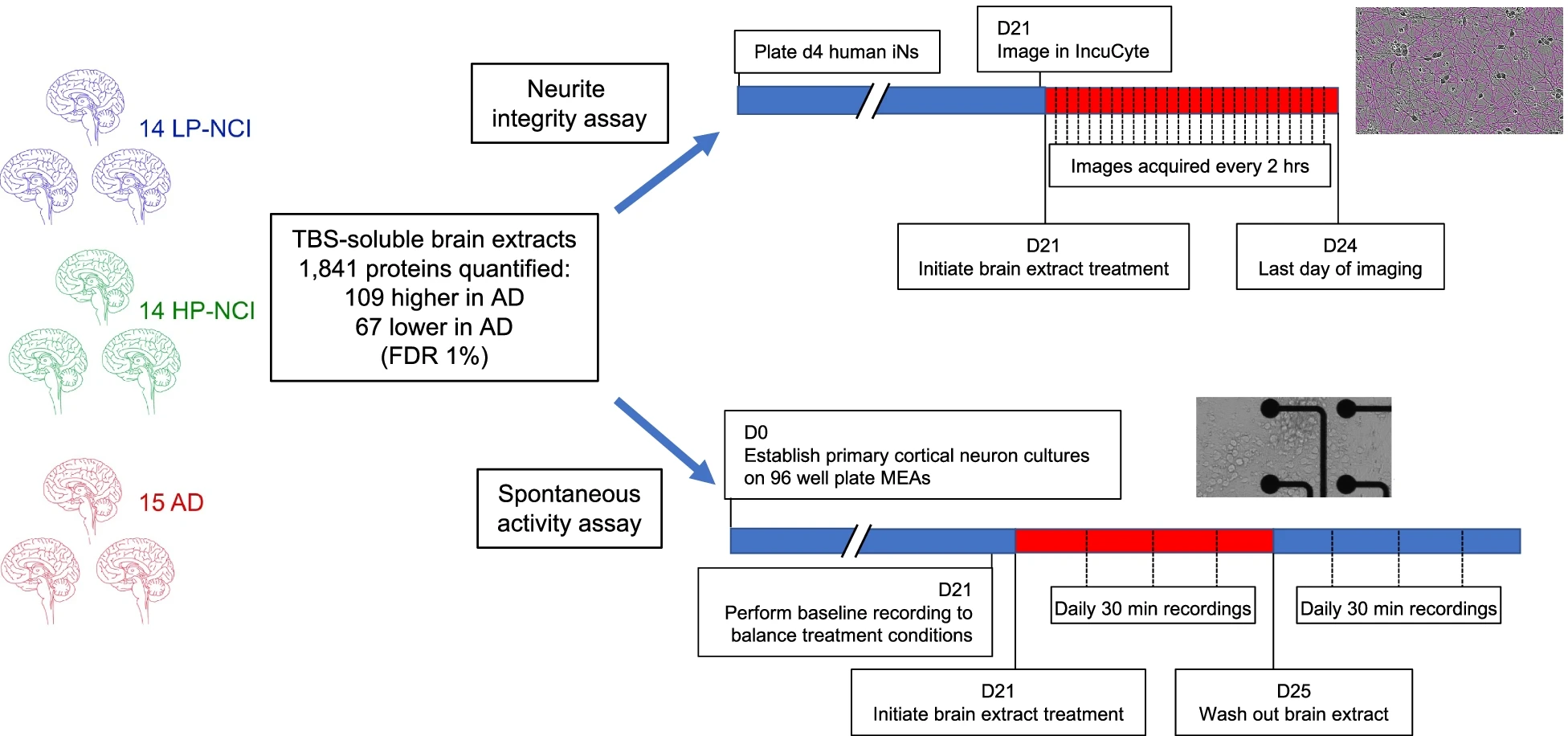 Researchers Identify a New Protein That May Contribute to Alzheimer’s Disease