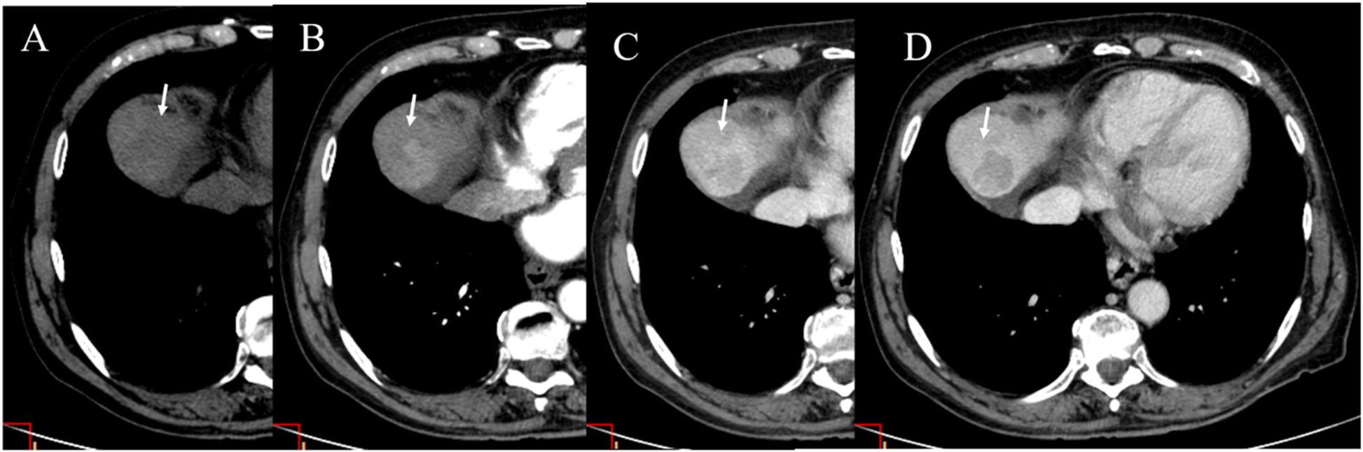 Fig. 6