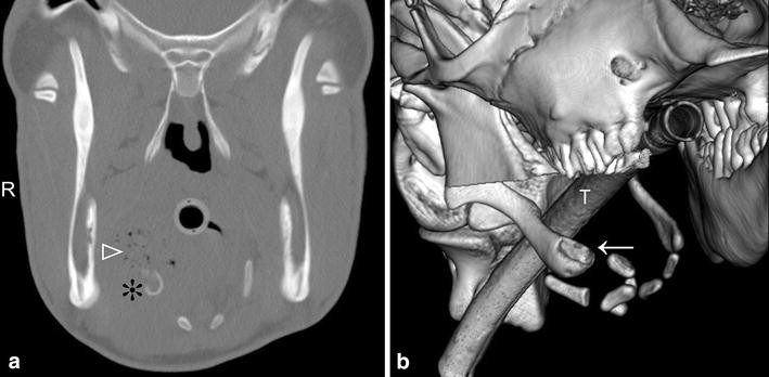 Fig. 4