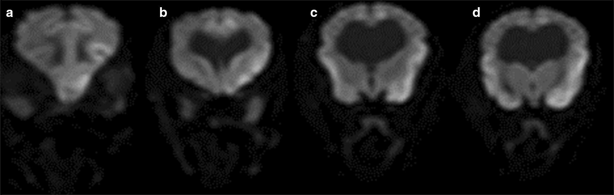 Fig. 2