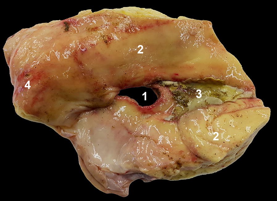 Fig. 2