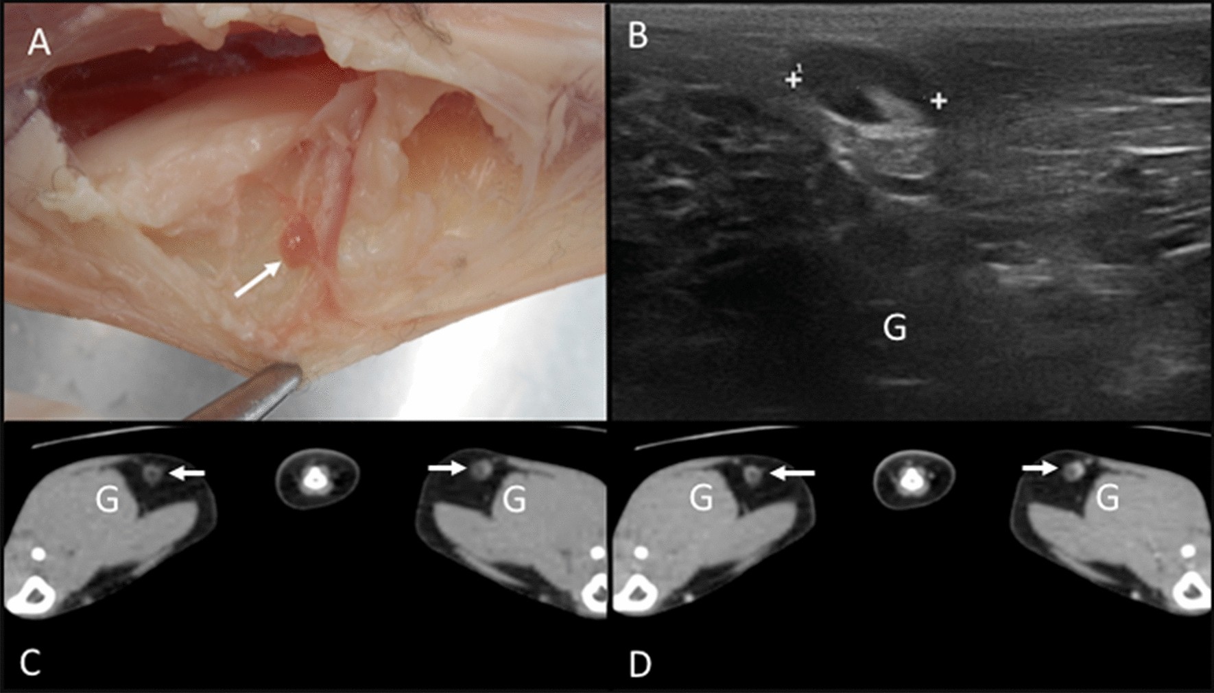 Fig. 15