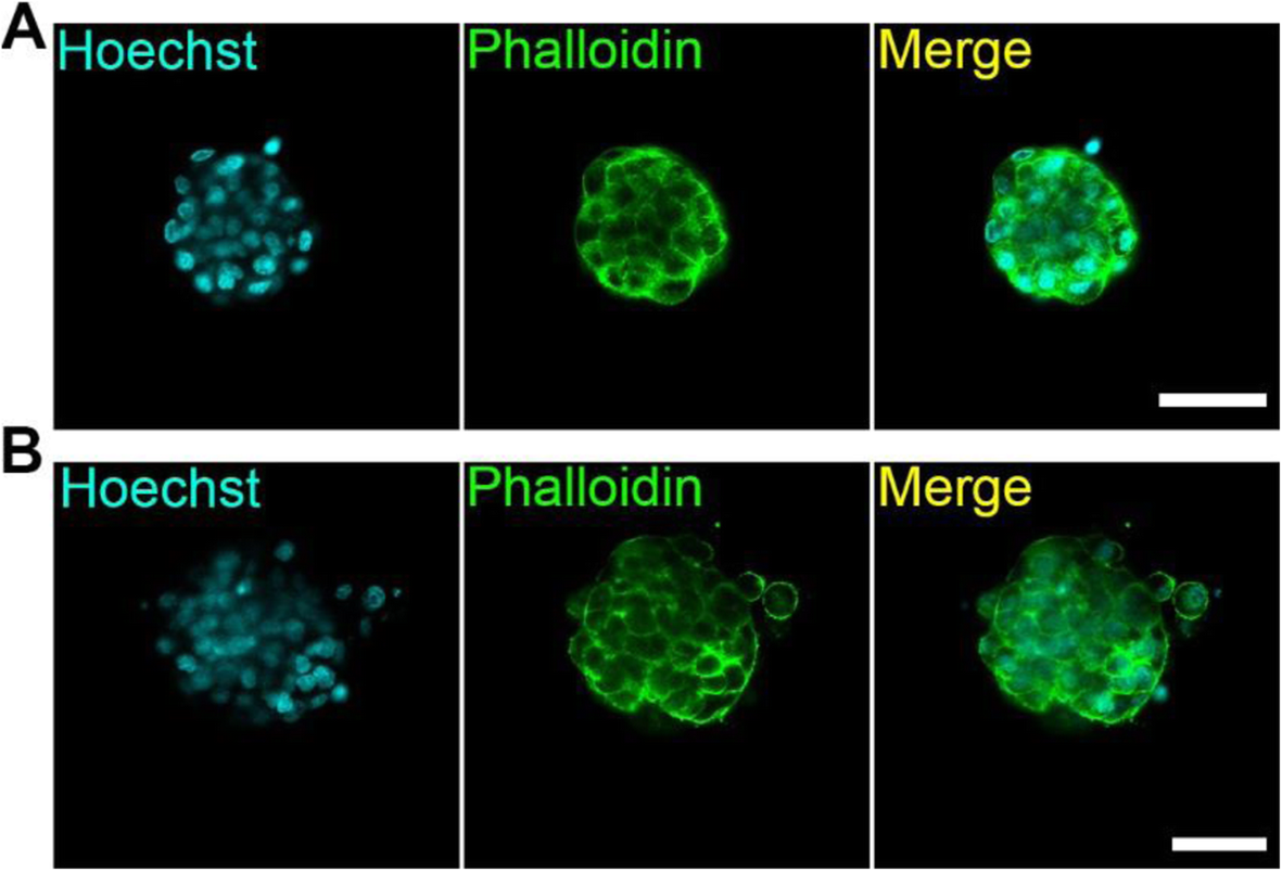 3D-tips: user-friendly mesh barrier pipette tips for 3D-spheroid culture |  Journal of Biological Engineering | Full Text