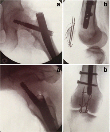 Fig. 4