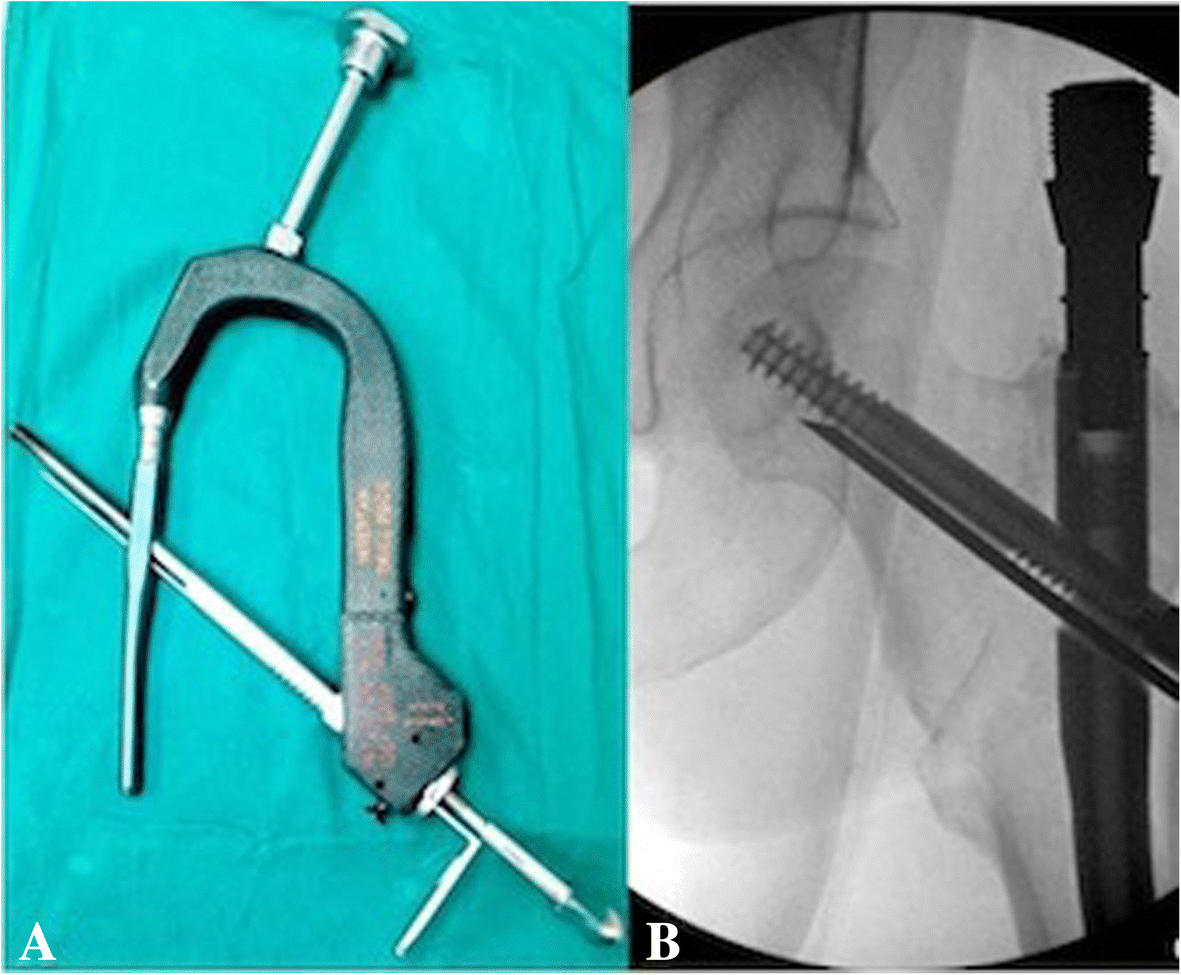 Fig. 6