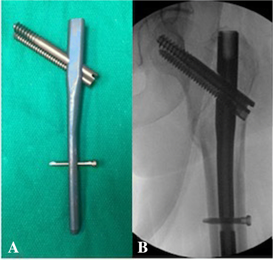 Fig. 9