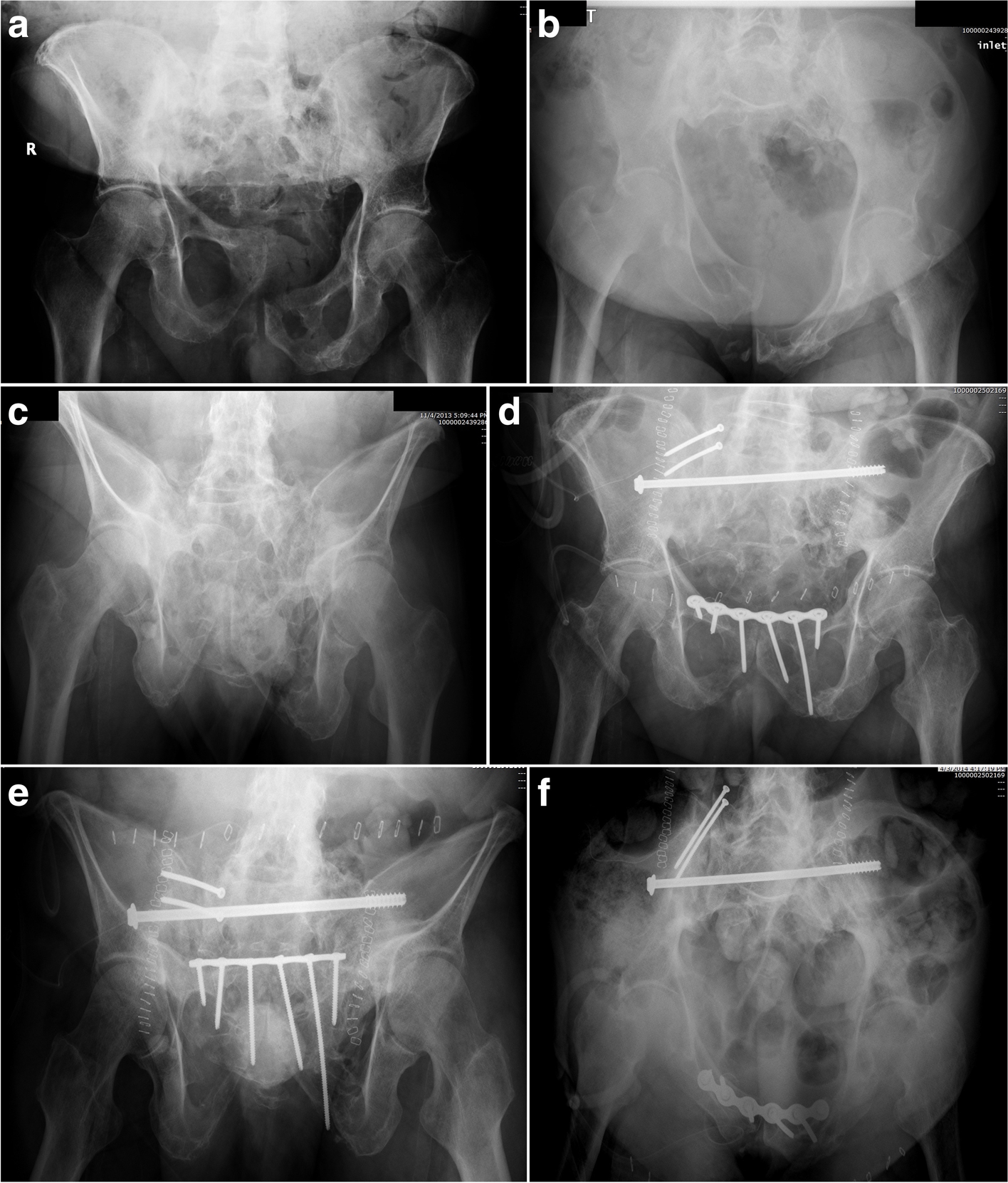 Fig. 10