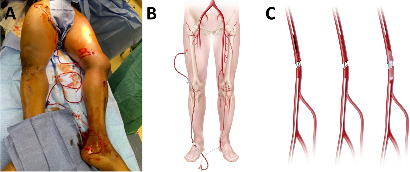 Fig. 2