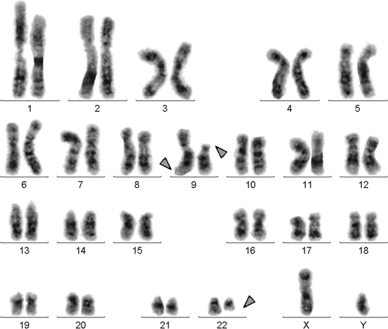 Fig. 1