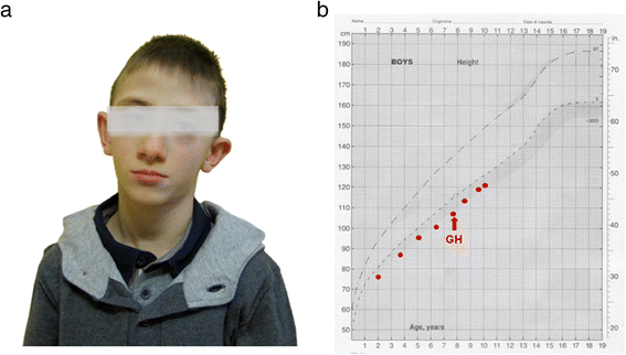 Fig. 1