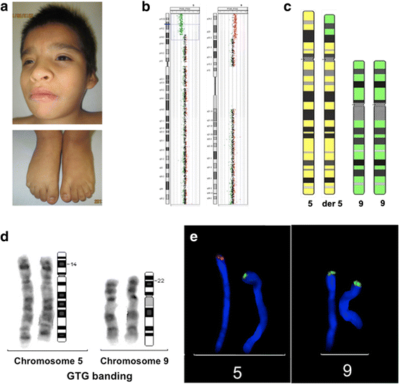 Fig. 2