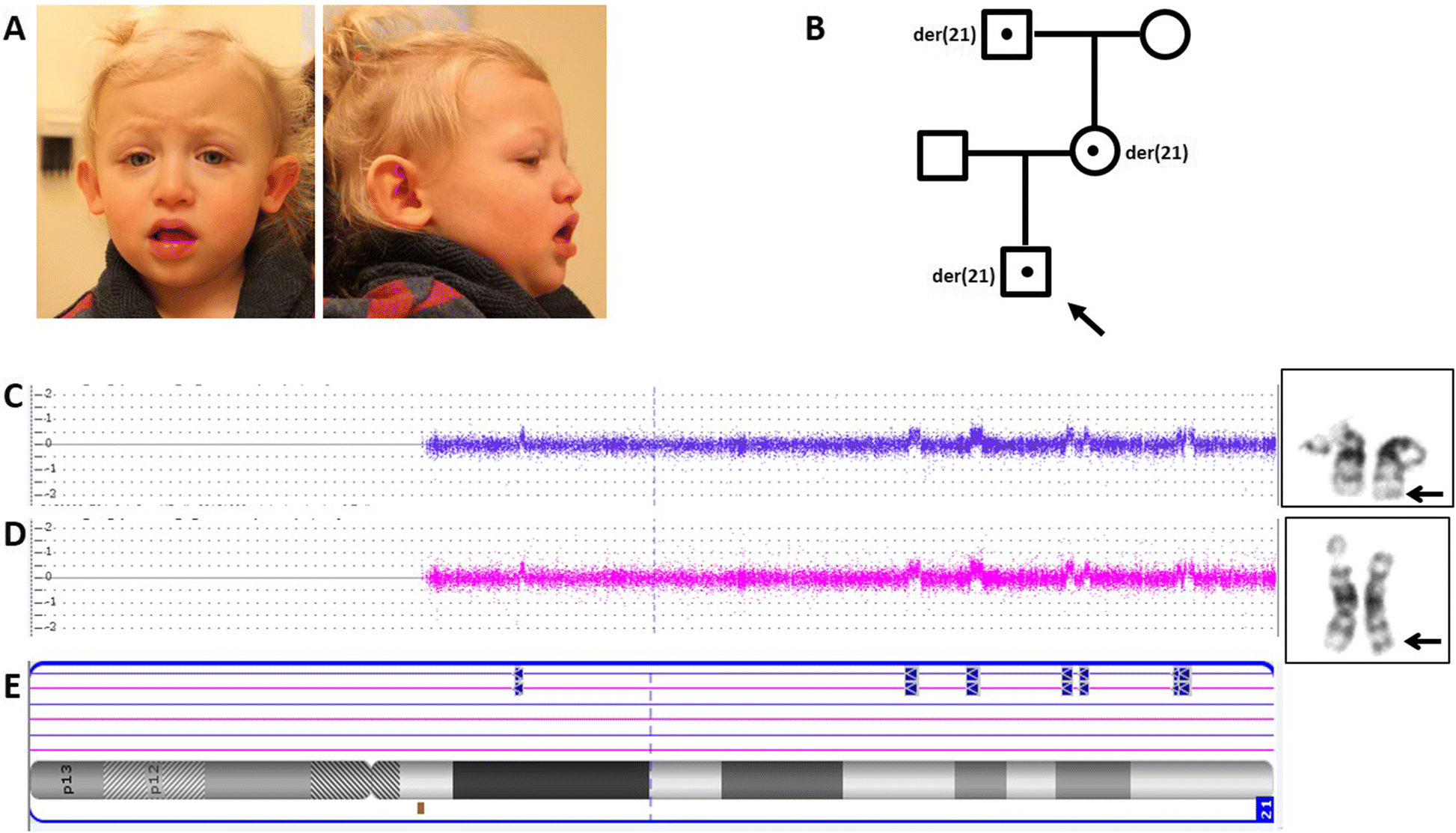 Fig. 1