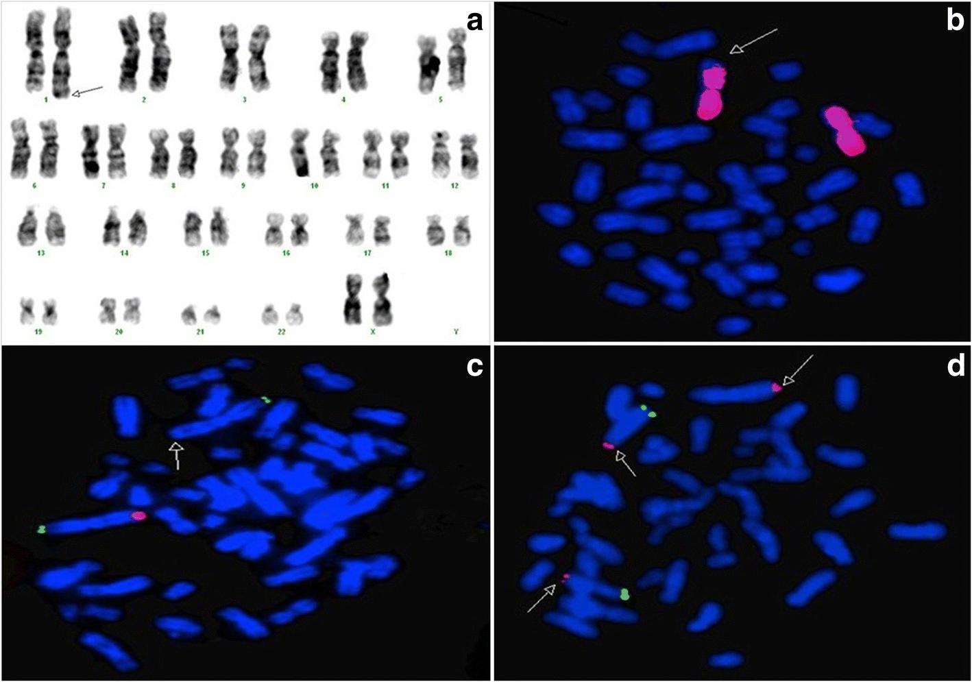 Fig. 3