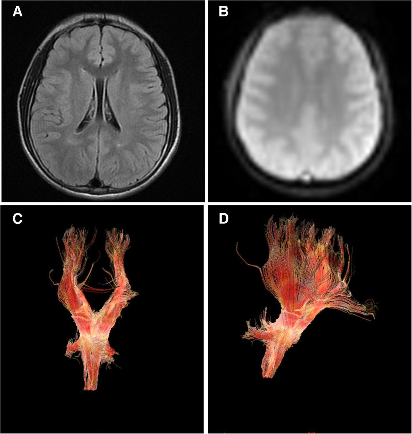 Fig. 4