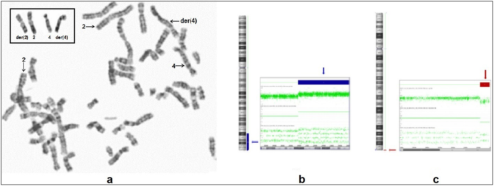 Fig. 2