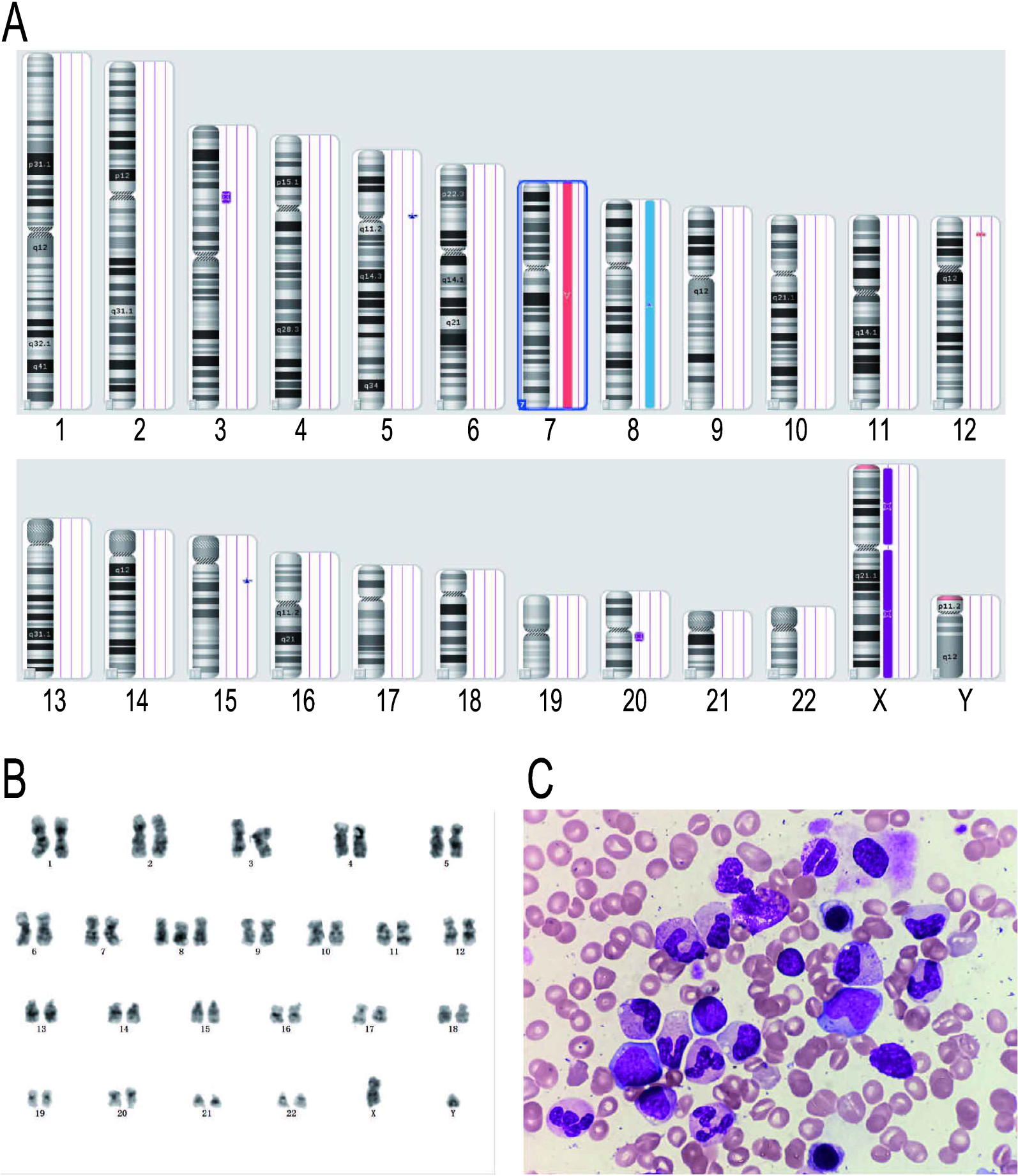 Fig. 1