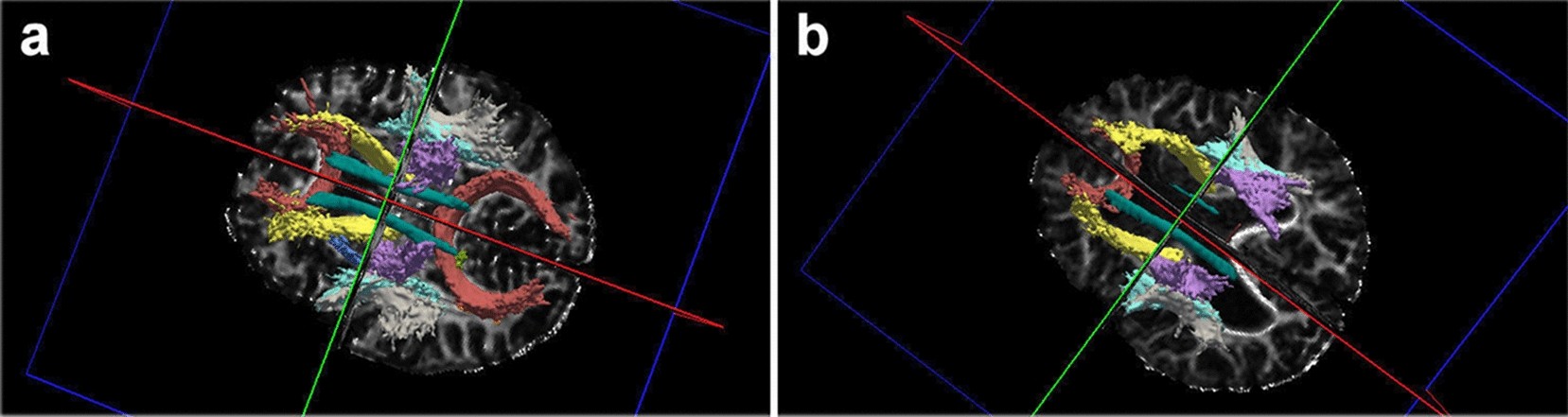 Fig. 4