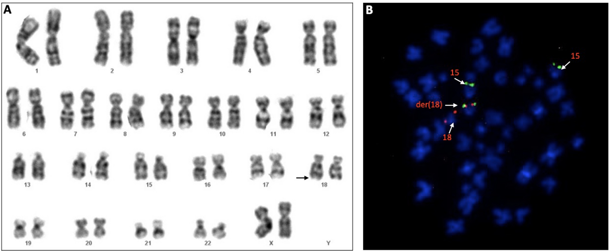 Fig. 2