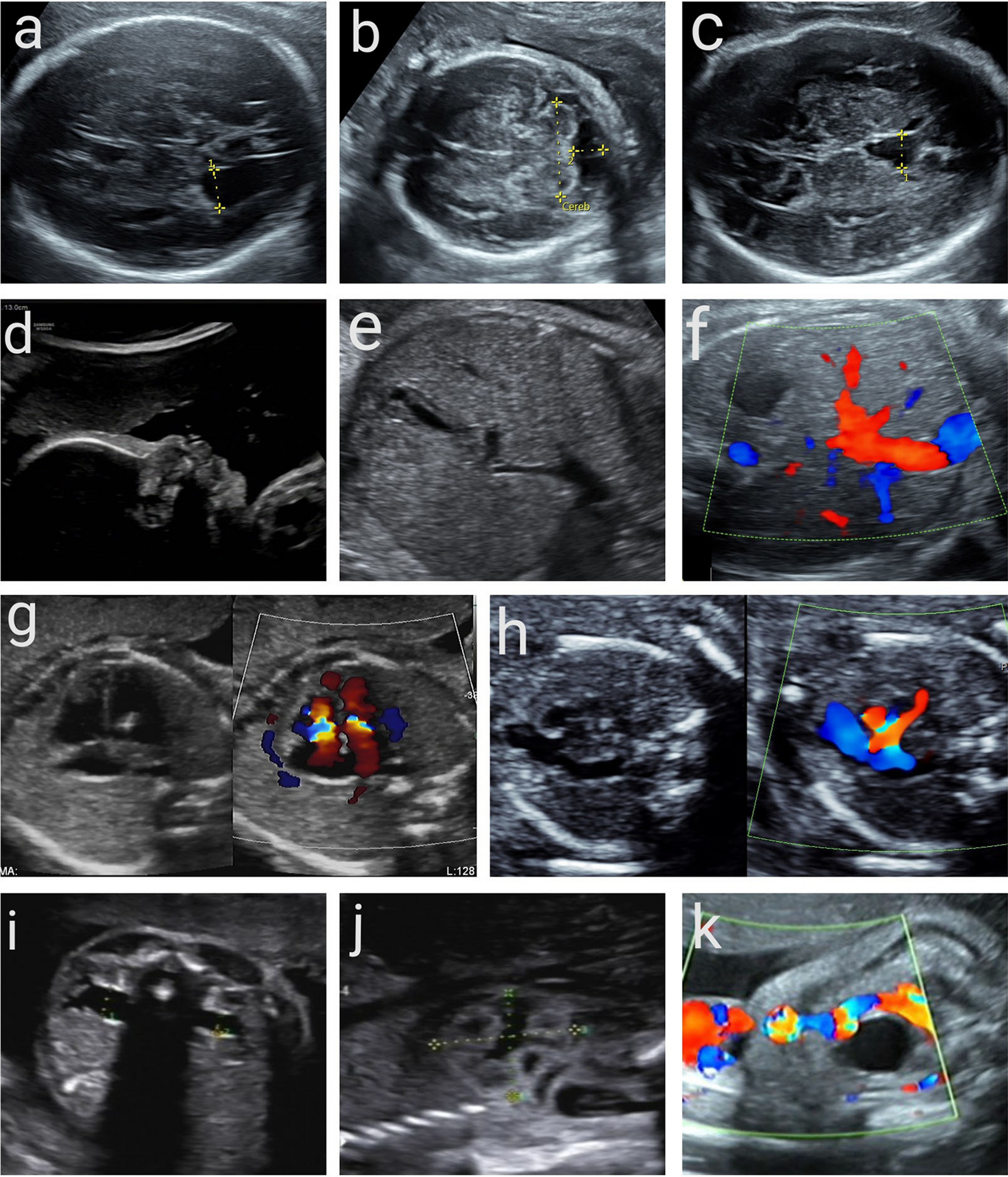 Fig. 2