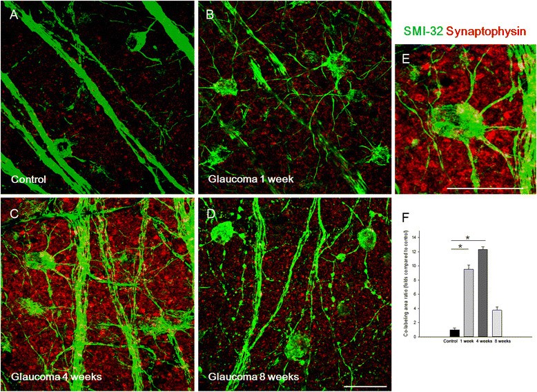 Alterations of the synapse of the inner retinal layers after chronic  intraocular pressure elevation in glaucoma animal model | Molecular Brain |  Full Text