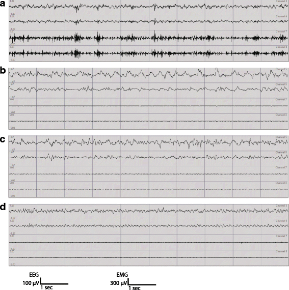 Fig. 1