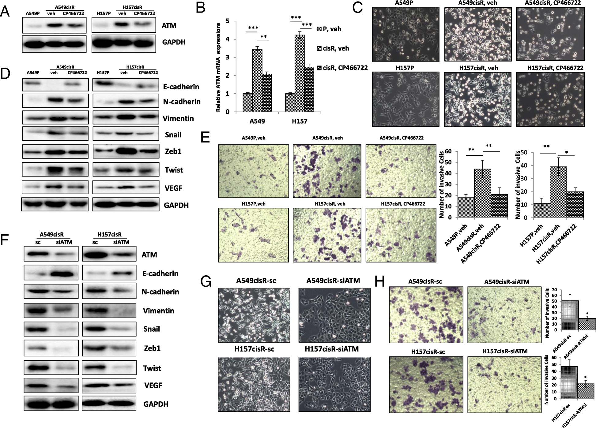 cisplatin resistant lung cancer cells