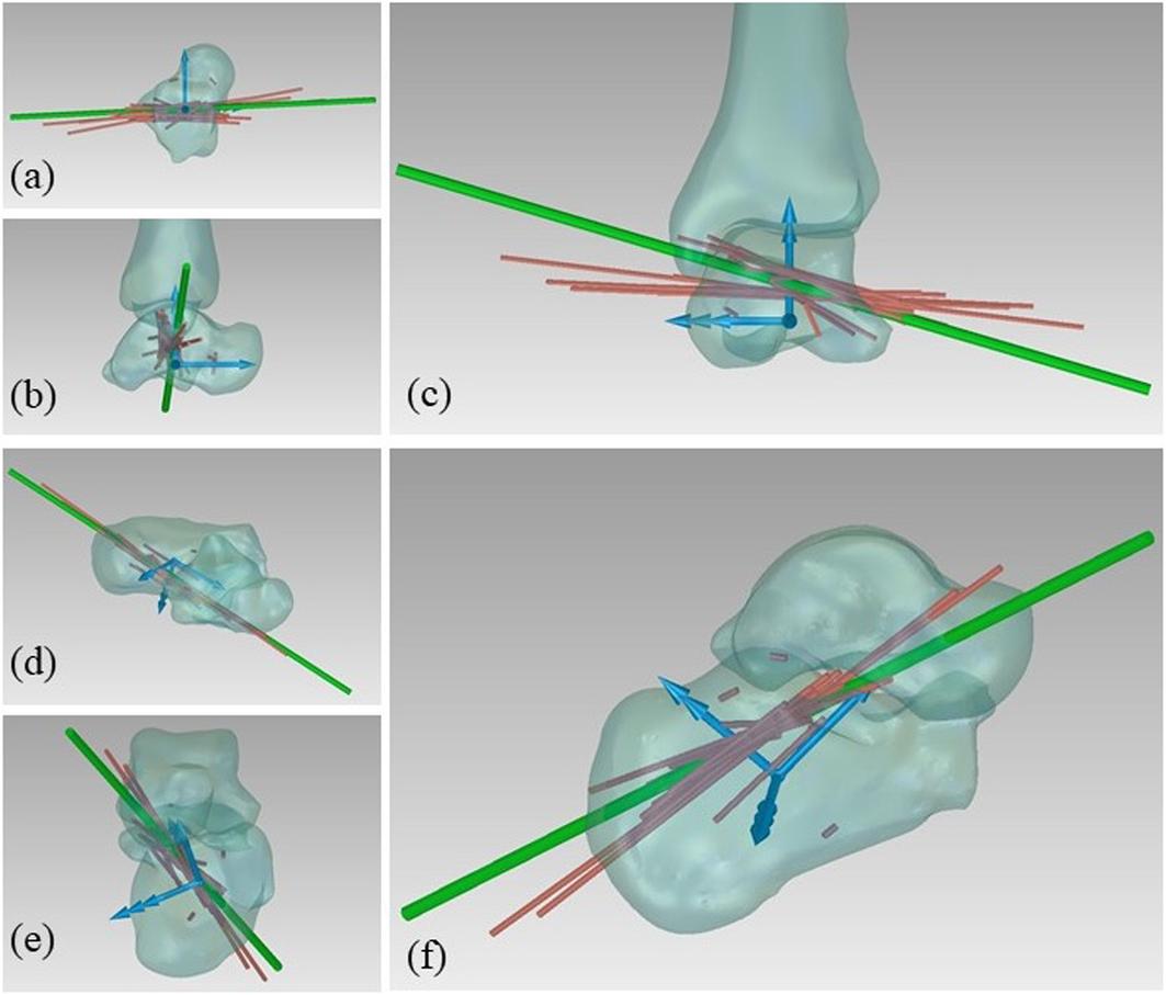 Fig. 12