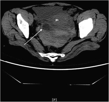 Fig. 11