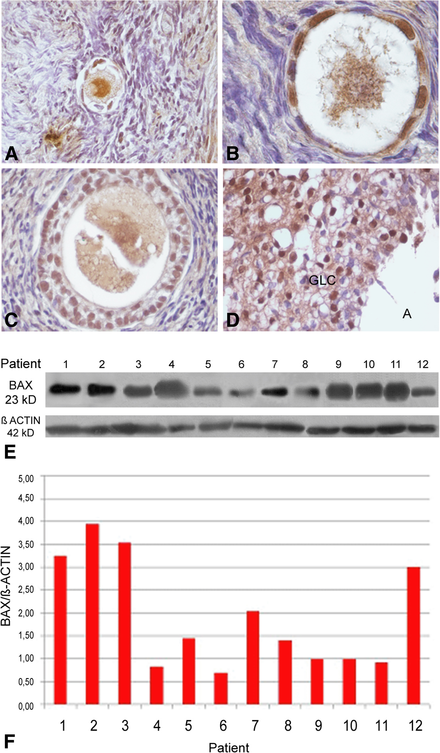 Fig. 4