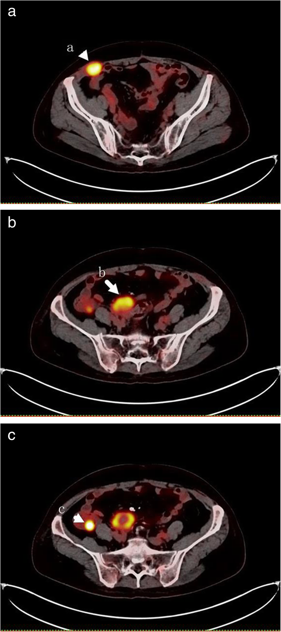 Fig. 1